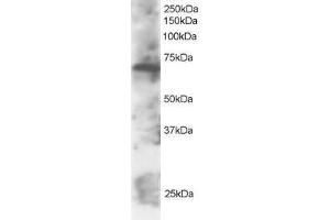 Image no. 1 for anti-SWAP Switching B-Cell Complex 70kDa Subunit (SWAP70) (C-Term) antibody (ABIN374192) (SWAP70 antibody  (C-Term))