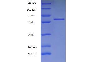 Transmembrane Protein 141 (TMEM141) (AA 1-108), (full length) protein (GST tag)