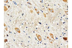 Anti-Dopamine Receptor D3 antibody, IHC(P) IHC(P): Rat Brain Tissue (DRD3 antibody  (C-Term))