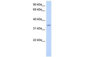 Image no. 1 for anti-Progestin and AdipoQ Receptor Family Member VI (PAQR6) (AA 107-156) antibody (ABIN6743533) (PAQR6 antibody  (AA 107-156))