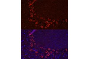 Immunofluorescence analysis of mouse brain using SLC1 antibody (ABIN6131630, ABIN6147868, ABIN6147869 and ABIN6219899) at dilution of 1:100. (SLC1A1 antibody  (AA 430-524))