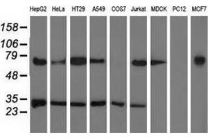 Western blot analysis of extracts (35 µg) from 9 different cell lines by using anti-PYCR2 monoclonal antibody. (PYCR2 antibody)