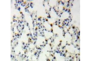 IHC-P analysis of Lung tissue, with DAB staining. (SIRT1 antibody  (AA 236-490))