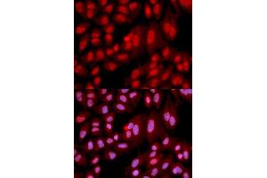 Immunofluorescence analysis of U2OS cell using PPP2R2A antibody. (PPP2R2A antibody  (AA 1-447))