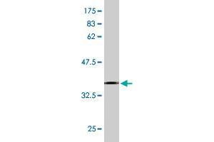 Western Blot detection against Immunogen (35. (ASCC2 antibody  (AA 672-757))