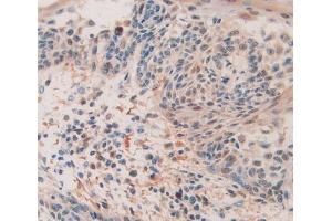 Figure. (QSOX1 antibody  (AA 394-519))