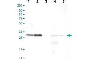 Western blot analysis of Lane 1: RT-4, Lane 2: U-251 MG, Lane 3: Human Plasma, Lane 4: Liver, Lane 5: Tonsil with SLC25A22 polyclonal antibody  at 1:250-1:500 dilution.