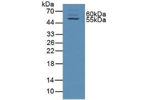 Detection of TXLNa in Rat Skin Tissue using Polyclonal Antibody to Taxilin Alpha (TXLNa) (alpha Taxilin antibody  (AA 1-234))