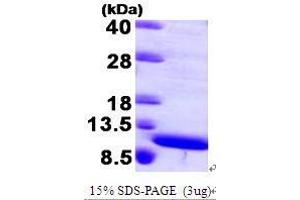 Figure annotation denotes ug of protein loaded and % gel used. (S100A8 Protein (AA 1-93))