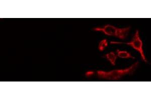 ABIN6267522 staining Hela cells by IF/ICC. (ZAP70 antibody  (pTyr493))