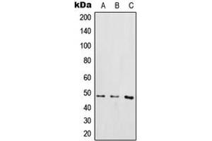 Western blot analysis of IKK gamma (pS85) expression in THP1 LPS-treated (A), Raw264.