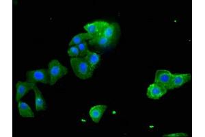 Immunofluorescent analysis of HepG2 cells using ABIN7170709 at a dilution of 1:100 and Alexa Fluor 488-congugated AffiniPure Goat Anti-Rabbit IgG(H+L) (STARD9 antibody  (AA 1960-2180))