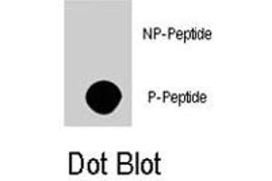 Dot blot analysis of AKT3 (phospho S472) polyclonal antibody  on nitrocellulose membrane.