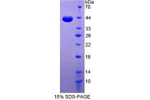 Image no. 1 for Desmocollin 2 (DSC2) (AA 136-471) protein (His tag) (ABIN6237164) (Desmocollin 2 Protein (DSC2) (AA 136-471) (His tag))