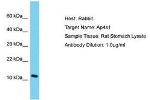 Image no. 1 for anti-Adaptor Related Protein Complex 4 sigma 1 (AP4s1) (AA 35-84) antibody (ABIN6750332) (AP4S1 antibody  (AA 35-84))