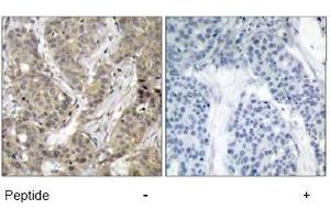 Image no. 1 for anti-Catenin (Cadherin-Associated Protein), beta 1, 88kDa (CTNNB1) (Ser37) antibody (ABIN197446)