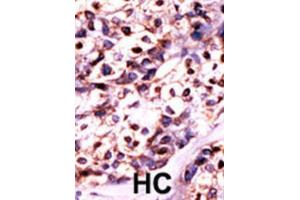 Immunohistochemistry (IHC) image for anti-Uridine-Cytidine Kinase 2 (UCK2) antibody (ABIN3003032)