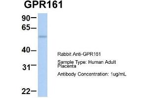 Host:  Rabbit  Target Name:  GPR161  Sample Type:  Human Adult Placenta  Antibody Dilution:  1. (GPR161 antibody  (Middle Region))