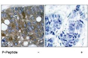 Image no. 1 for anti-Heat Shock 27kDa Protein 1 (HSPB1) (pSer15) antibody (ABIN196894) (HSP27 antibody  (pSer15))