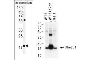 Image no. 1 for anti-Ubiquitin-Conjugating Enzyme E2D 1 (UBE2D1) (C-Term) antibody (ABIN357485) (UBE2D1 antibody  (C-Term))