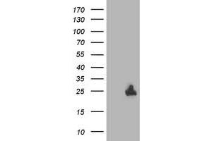 Western Blotting (WB) image for anti-Deoxythymidylate Kinase (Thymidylate Kinase) (DTYMK) antibody (ABIN1497918)