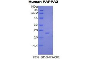 SDS-PAGE (SDS) image for Pappalysin 2 (PAPPA2) (AA 1309-1492) protein (His tag) (ABIN2121812) (PAPPA2 Protein (AA 1309-1492) (His tag))