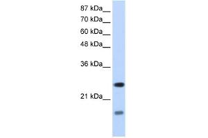 WB Suggested Anti-SRAntibody Titration:  1. (SRP14 antibody  (N-Term))