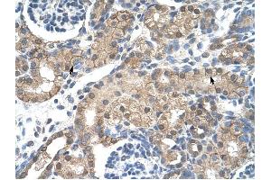 CHRNB2 antibody was used for immunohistochemistry at a concentration of 4-8 ug/ml to stain Epithelial cells of renal tubule (arrows) in Human Kidney.