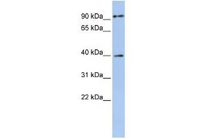 WB Suggested Anti-MAGEA6 Antibody Titration:  0. (MAGEA6 antibody  (Middle Region))