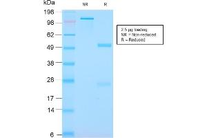 SDS-PAGE Analysis Purified S100A8/A9 Complex Recombinant Rabbit Monoclonal (MAC3157R). (Recombinant S100A8 antibody)