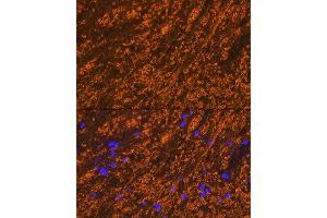 Immunofluorescence analysis of rat brain cells using PLP1 Rabbit pAb (ABIN7269724) at dilution of 1:100 (40x lens). (PLP1 antibody  (AA 145-210))