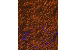 Immunofluorescence analysis of rat brain cells using PLP1 Rabbit pAb (ABIN7269724) at dilution of 1:100 (40x lens).