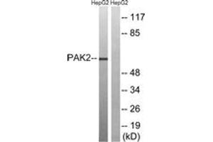 Western blot analysis of extracts from HepG2 cells, treated with serum 20% 15', using PAK2 (Ab-192) Antibody.