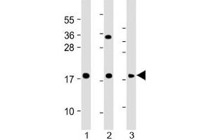 Western blot testing of human 1) HeLa, 2) THP1 and 3) RPMI 8226 cell lysate with GPX7 antibody at 1:2000. (Glutathione Peroxidase 7 antibody  (AA 73-107))