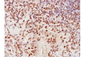 Paraformaldehyde-fixed, paraffin embedded mouse small intestine, Antigen retrieval by boiling in sodium citrate buffer (pH6) for 15min, Block endogenous peroxidase by 3% hydrogen peroxide for 30 minutes,  Blocking buffer (normal goat serum) at 37°C for 20min, Antibody incubation with RPA32 Polyclonal Antibody (bs-4182R) at 1:400 overnight at 4°C, followed by a conjugated secondary and DAB staining. (RPA2 antibody  (AA 101-200))