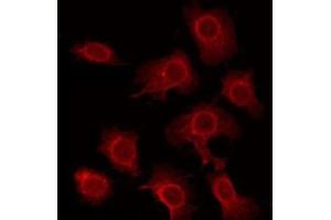 ABIN6275855 staining HeLa by IF/ICC. (STK33 antibody  (N-Term))