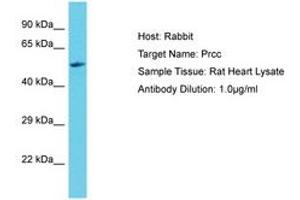 Image no. 1 for anti-Papillary Renal Cell Carcinoma (Translocation-Associated) (PRCC) (C-Term) antibody (ABIN6750395) (PRCC antibody  (C-Term))