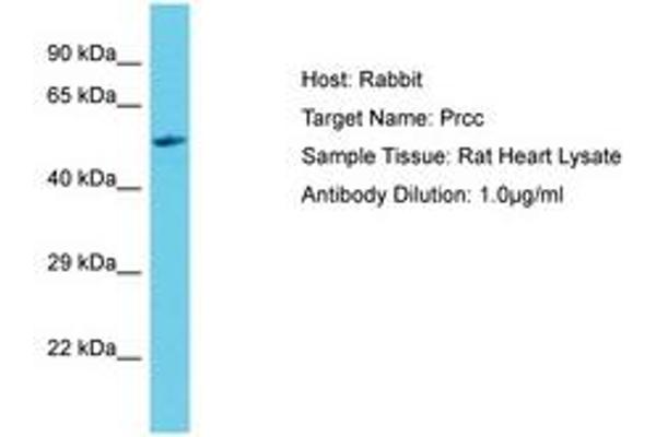 PRCC antibody  (C-Term)