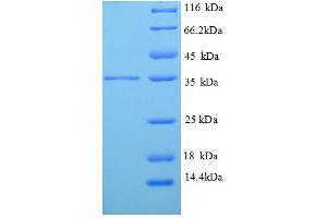 Tropomyosin-2 (TPM2) (AA 14-284), (partial) protein (His tag)