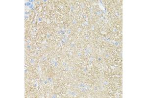Immunohistochemistry of paraffin-embedded mouse brain using CD90/Thy1 antibody (ABIN7266228) at dilution of 1:100 (40x lens). (CD90 antibody  (AA 31-81))