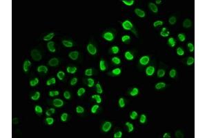 Immunofluorescence staining of Hela cells(treated with 100 mM EGF for 20 min) with ABIN7127752 at 1:206,counter-stained with DAPI.