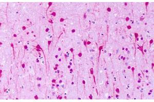 Anti-GPR1 antibody IHC staining of human brain, neurons. (G Protein-Coupled Receptor 1 antibody  (N-Term))