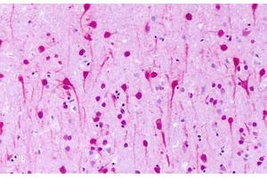 Anti-GPR1 antibody IHC staining of human brain, neurons.