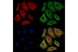ABIN6264012 and ABIN6273286 staining Hela cells by IF/ICC. (PAFAH2 antibody  (Internal Region))