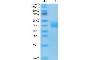 Human SLAMF6 on Tris-Bis PAGE under reduced condition. (SLAMF6 Protein (AA 22-226) (His-Avi Tag))