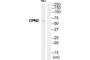 Western blot analysis of extracts from HeLa cells, using CPN2 antibody.