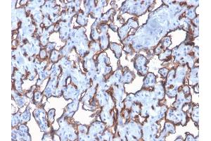 Immunohistochemistry (IHC) image for anti-Platelet/endothelial Cell Adhesion Molecule (PECAM1) antibody (ABIN6940291)
