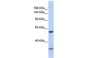 Image no. 1 for anti-Zinc Finger Protein 777 (ZNF777) (AA 91-140) antibody (ABIN6740582) (ZNF777 antibody  (AA 91-140))