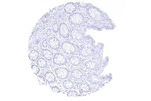 colon descendens mucosa (CPA1 antibody)