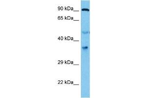 Western Blotting (WB) image for anti-Eukaryotic Translation Initiation Factor 2 Subunit 1 (EIF2S1) (N-Term) antibody (ABIN2778882)